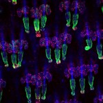 تصویر سلولهای بنیادی دم موش به رنگ سبز از بارون فوچز، نیویورک، برنده جایزه هشتم